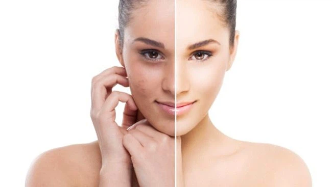 sharpen the skin to UV radiation