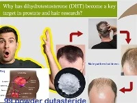 DHT Prostat ve Saç Araştırmalarında Neden Önemli Bir Hedef Haline Geldi?